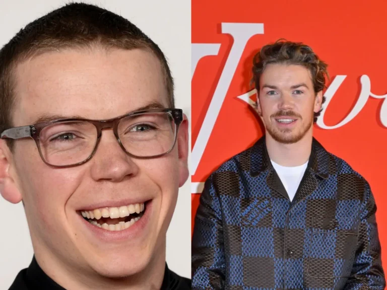 will-poulter-teeth-before-after.webp